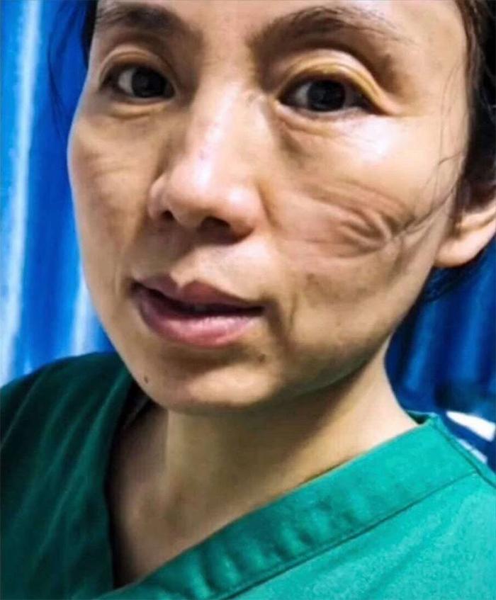 武汉疫情的开始时间及其影响 武汉疫情的开始时间及其影响