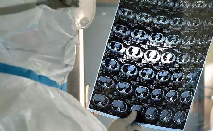 【合肥第一例新冠/合肥第一例新型冠状病毒】 【合肥第一例新冠/合肥第一例新型冠状病毒】